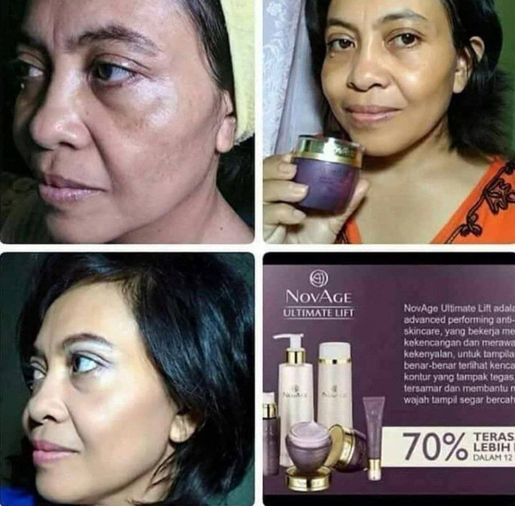 کرم جوان کننده صورت