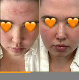 کپسول اسکین تامین 30 عددی